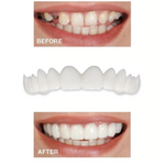 2 Pcs Snap On Veneers – Instant Smile Transformation for Confidence | Upper and Lower Teeth Cover 5