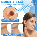 Auto Skin Tag Remover Kit – Best Skin Tag Remover for Painless & Efficient Skin Tag Removal 1