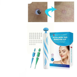 Auto Skin Tag Remover Kit – Best Skin Tag Remover for Painless & Efficient Skin Tag Removal 3