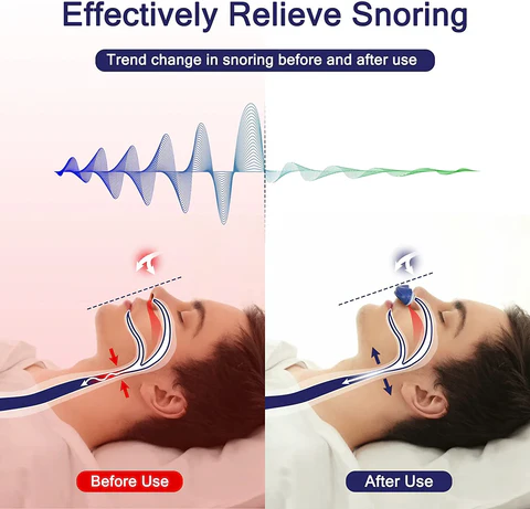 Micro CPAP Sleep Apnea Machine – Compact Anti-Snoring Device for Comfortable Travel & Sleep 3
