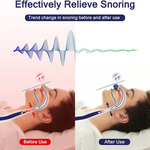Micro CPAP Sleep Apnea Machine – Compact Anti-Snoring Device for Comfortable Travel & Sleep 3
