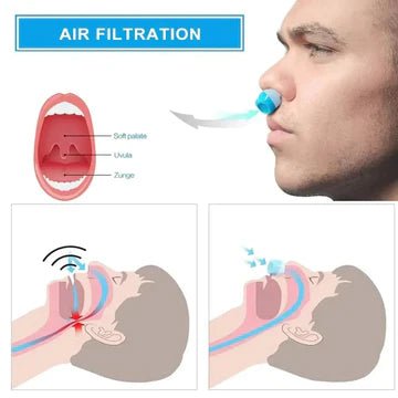 Micro CPAP Sleep Apnea Machine – Portable Anti - Snoring Solution for Travel & Comfort - Trendyhousehold.co